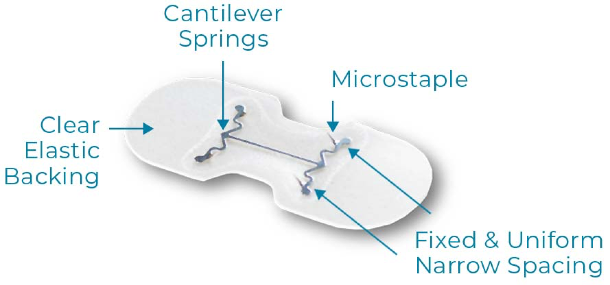 technology-micromend-labels