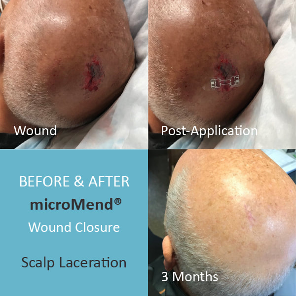 before and after scalp wound